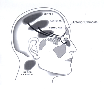   Head Schematic 